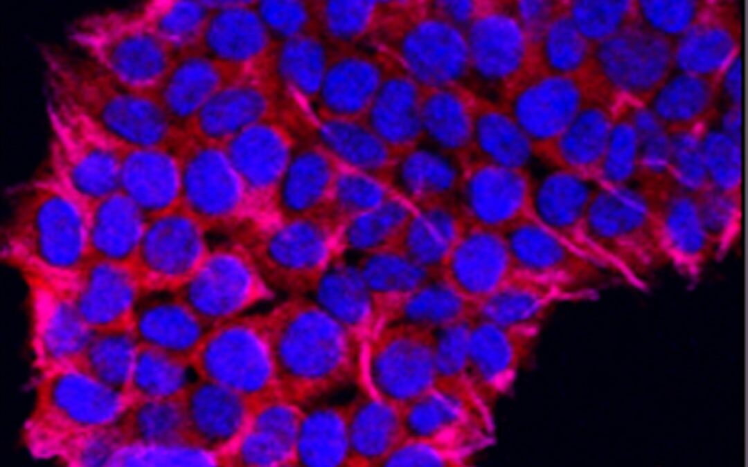 SMS-iT CRM’s Role in the Era of Voice-Powered Customer Support Interaction Analysis and Optimization